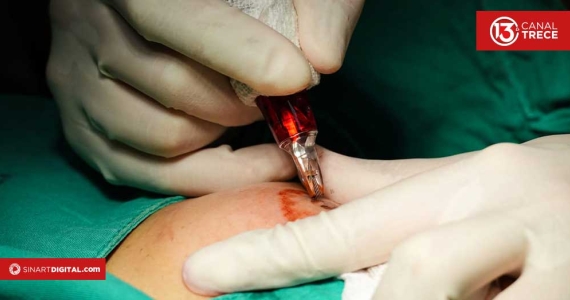 San Juan de Dios incorpora micropigmentación a la reconstrucción mamaria