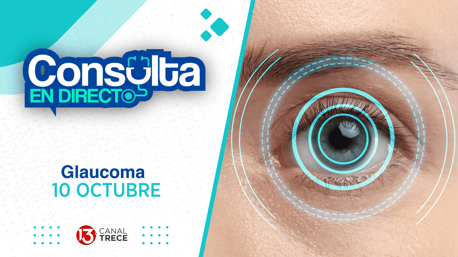 Glaucoma | Consulta en Directo 10 Octubre 2024. Programa Completo