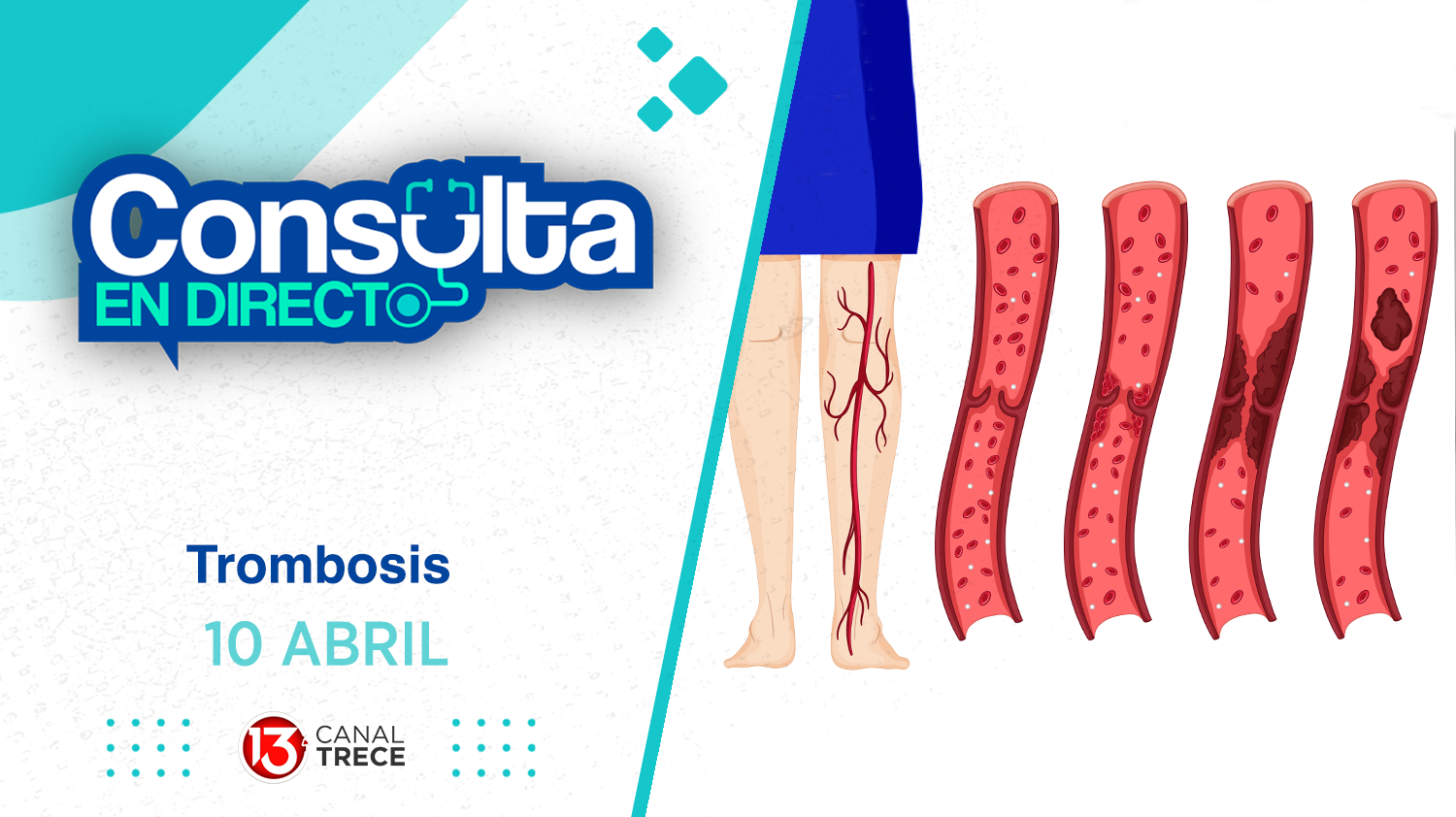  Consulta en Directo | 10 Abril 2025 