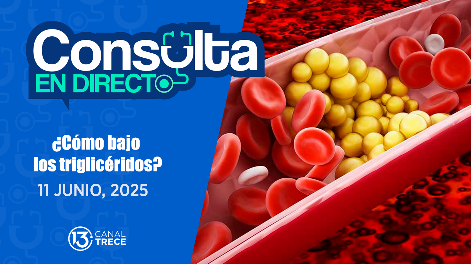  Consulta en Directo: ¿Cómo bajo los triglicéridos? 