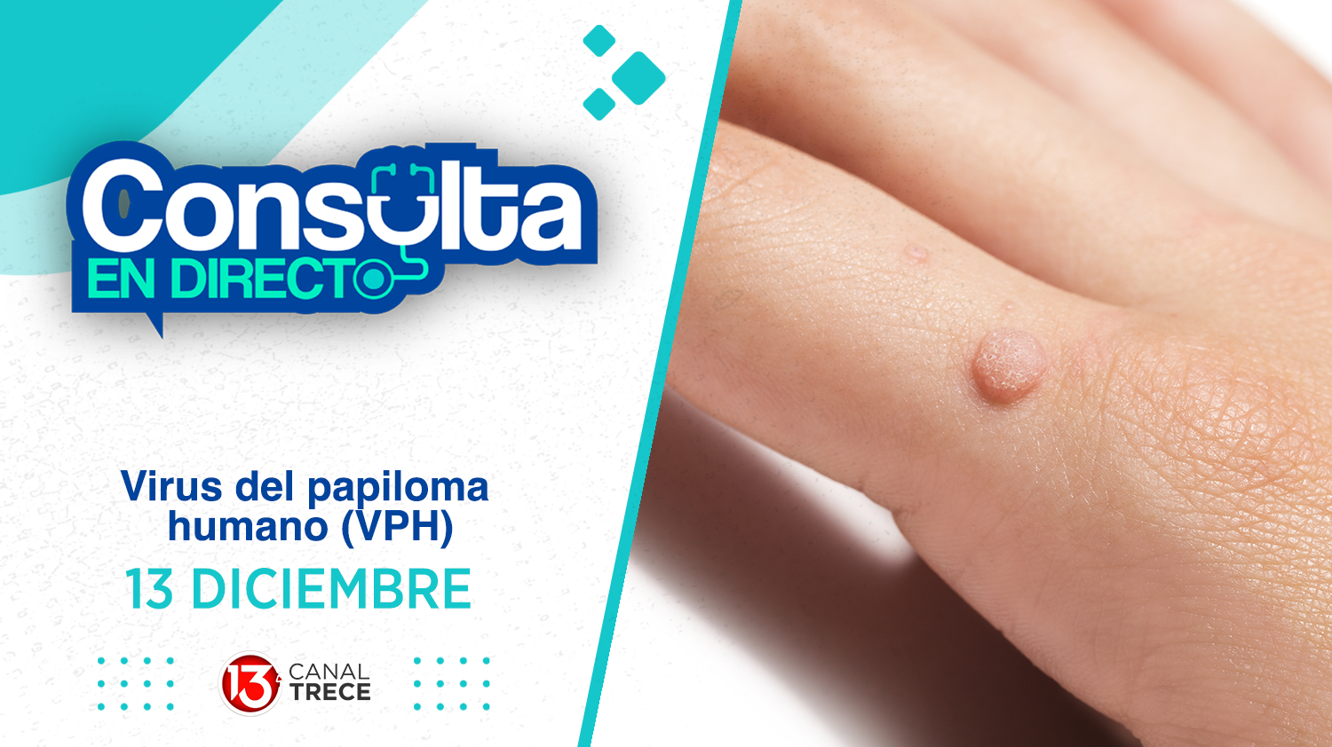 Papiloma Humano - Consulta en Directo | 13 Diciembre 2024. Programa completo