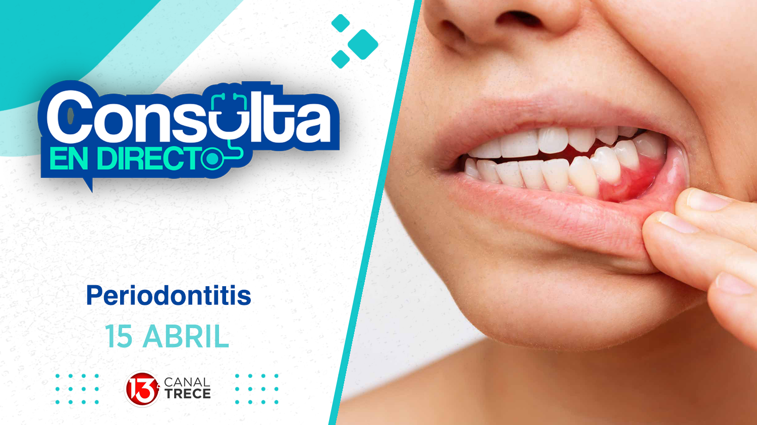  Consulta en Directo | 15 Abril 2025