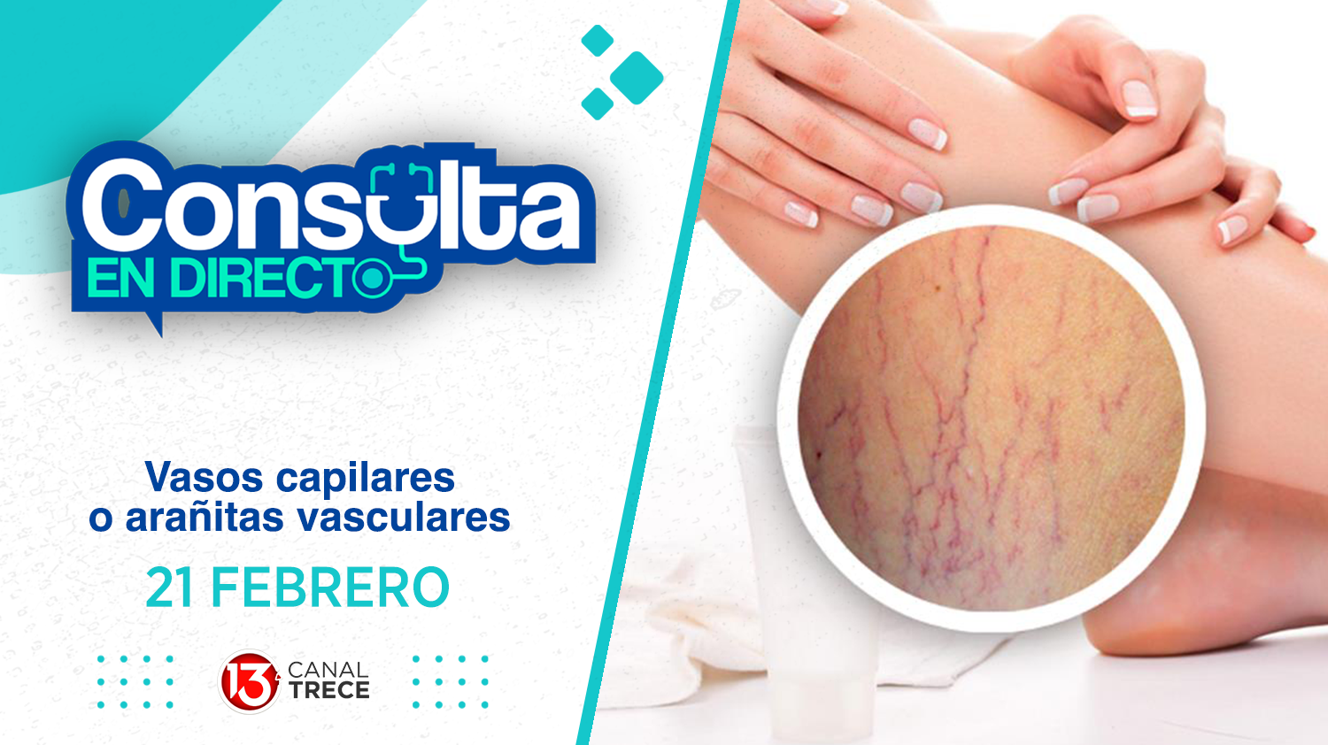 Vasos capilares - Consulta en Directo | 21 Febrero 2025