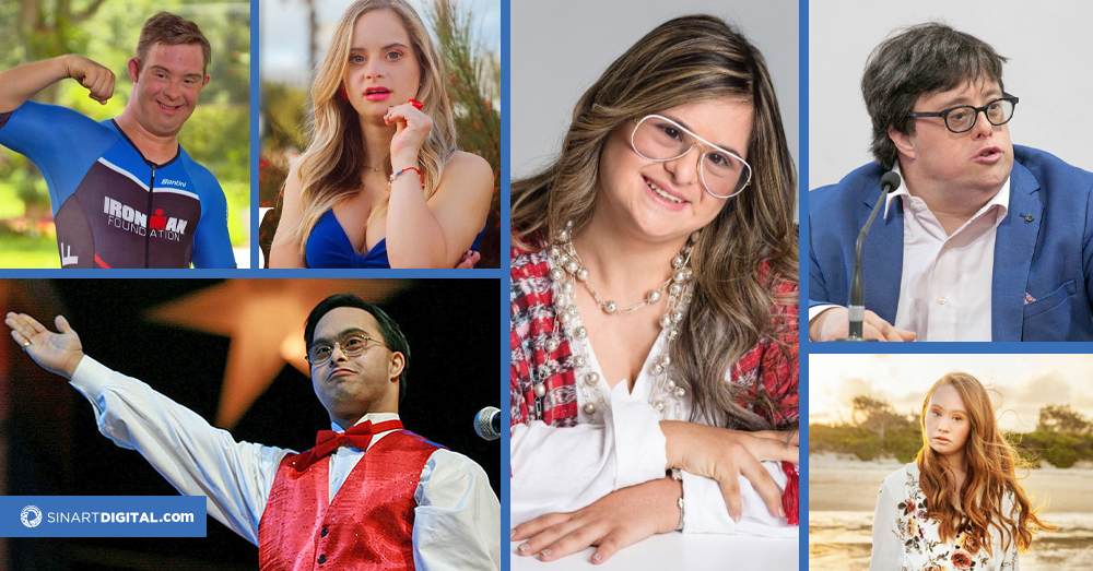 Síndrome de Down: Avances científicos e hitos históricos en su inclusión social