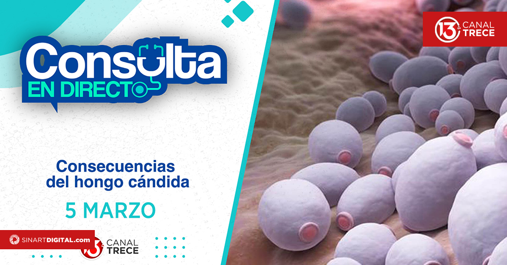 Consulta en Directo | 5 Marzo 2025