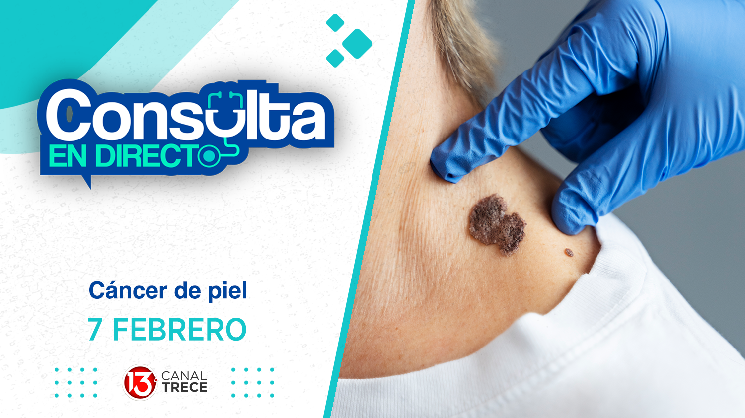 Cáncer de Piel - Consulta en Directo | 7 Febrero 2025