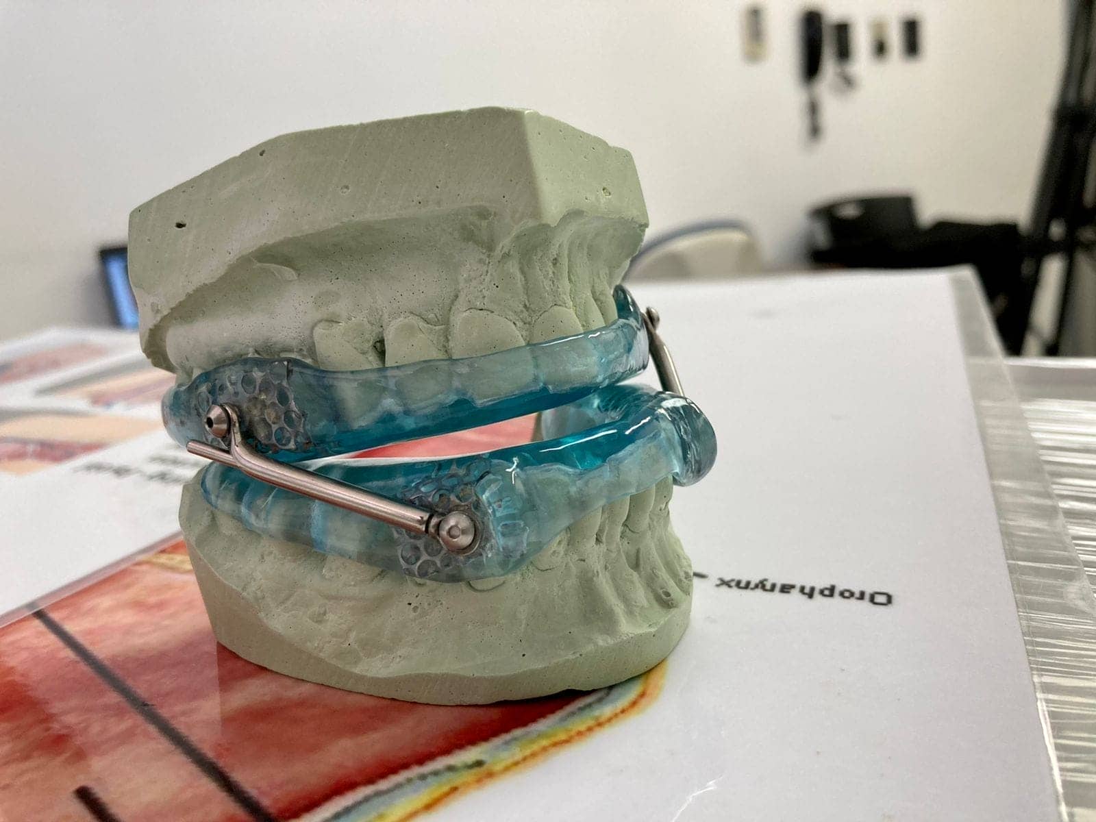 Aparatos dentales para mejorar la calidad del sueño