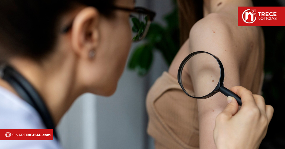 Consulta dermatológica gratuita beneficiará a más de 100 heredianos este sábado