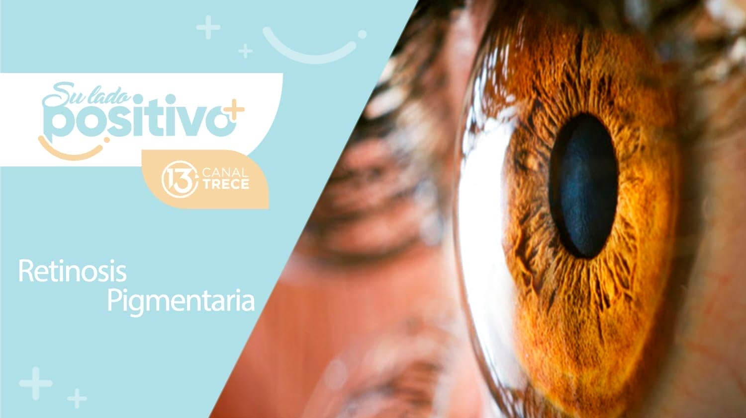 Retinosis pigmentaria | 28 setiembre 2023