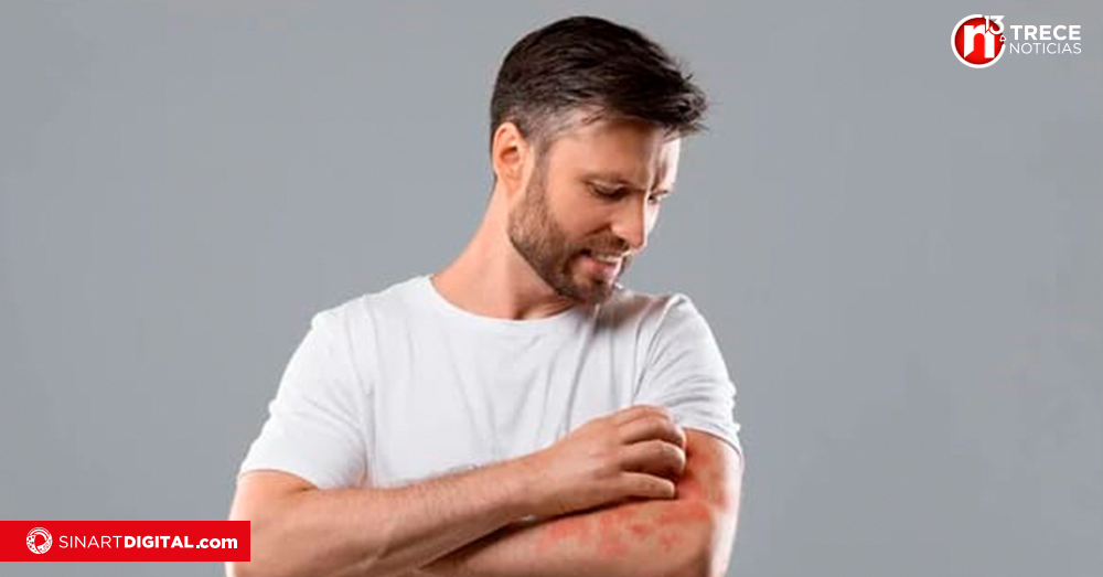 Microbiólogos advierten sobre necesidad de mejorar capacidad para diagnosticar infecciones por hongos