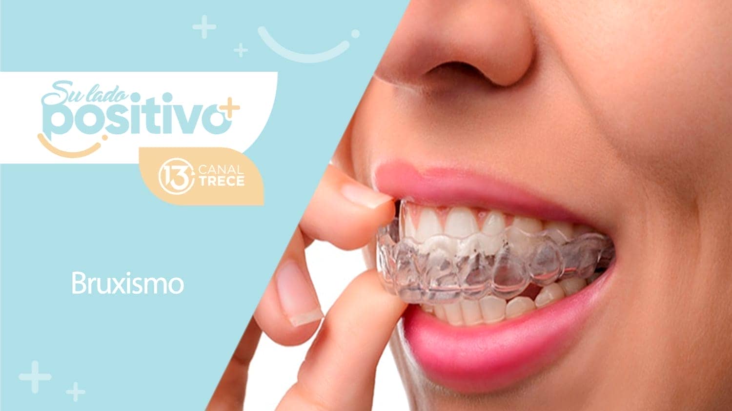 Bruxismo | 12 de setiembre 2023