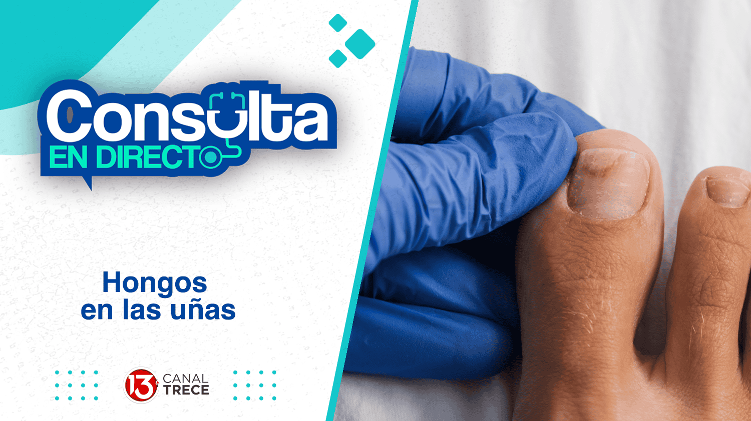 Hongos en las uñas | Consulta en directo 13 septiembre 2024. Programa Completo.