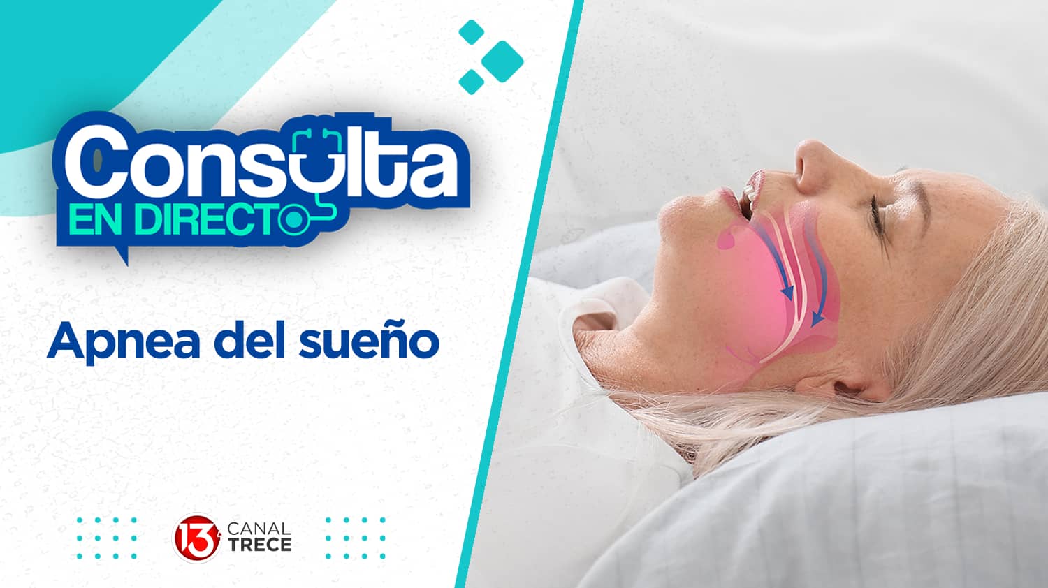 Apnea del sueño | Consulta en directo 16 mayo 2024. Programa Completo. 