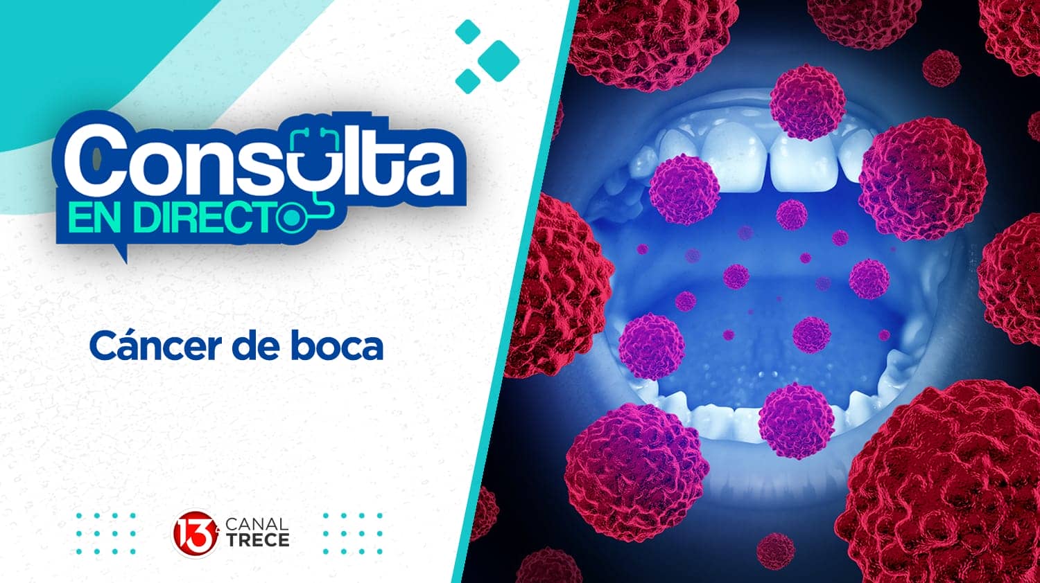 Cáncer de boca | Consulta en directo 22 febrero 2024. Programa Completo.