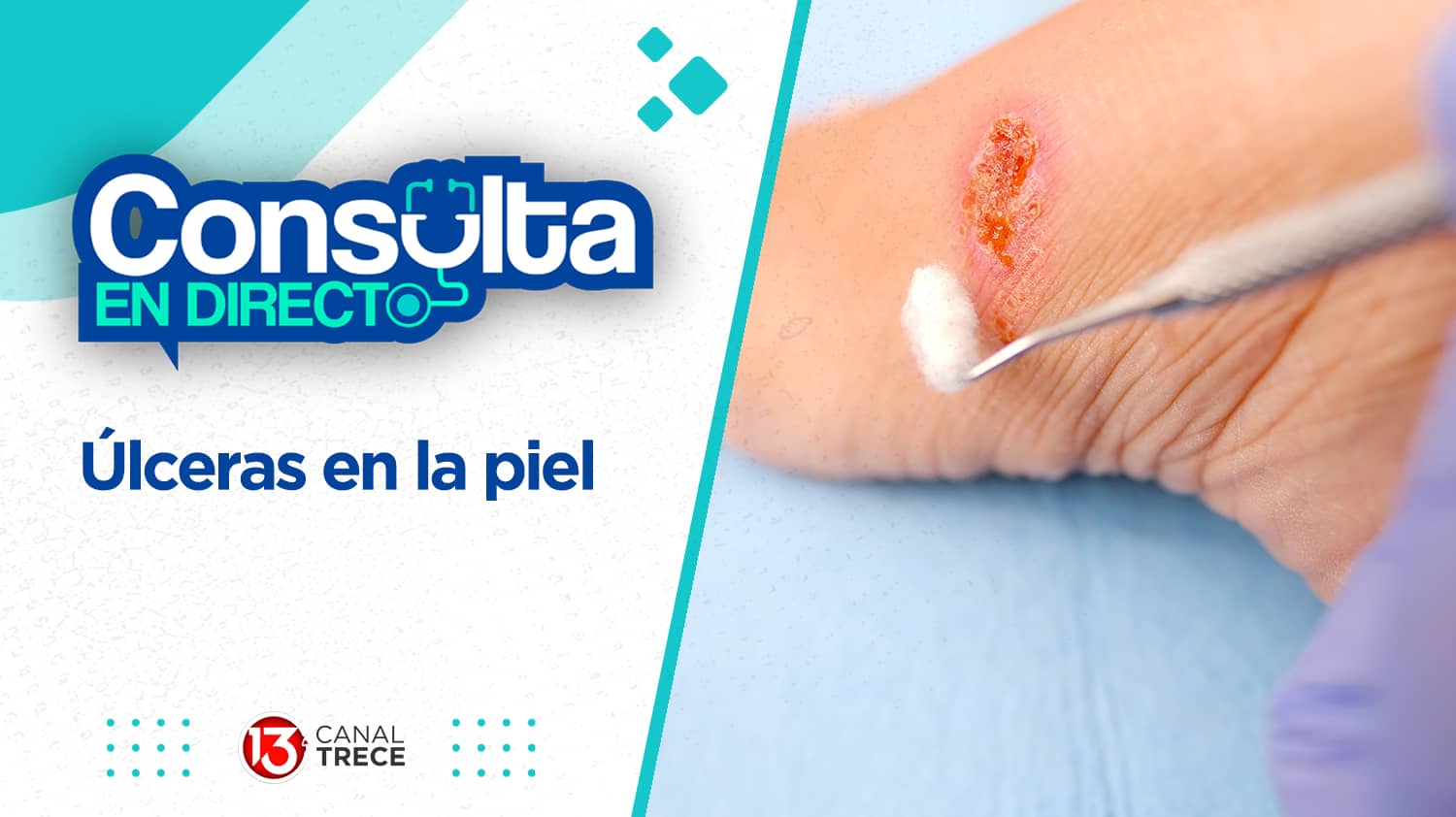 Úlceras en la piel | Consulta en directo 27 marzo 2024. Programa Completo. 