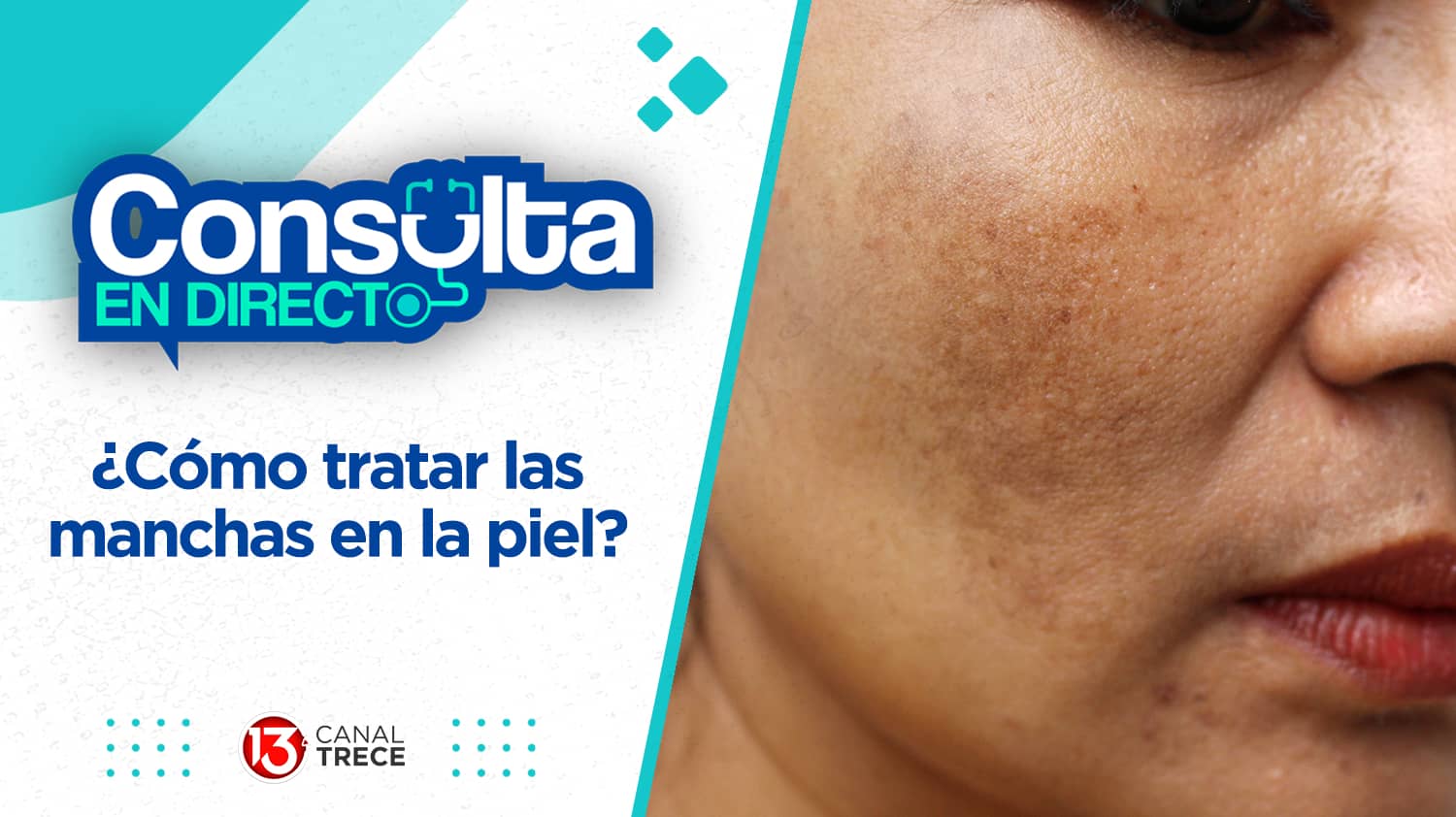 ¿Cómo tratar las manchas en la piel? | Consulta en directo 30 mayo 2024. Programa Completo. 