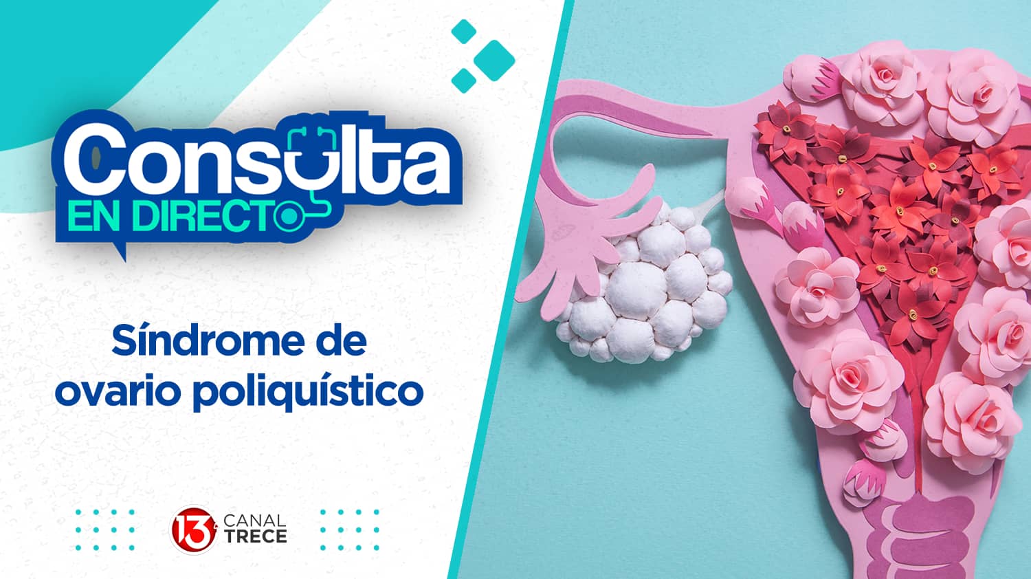 Síndrome de Ovario Poliquístico. | Consulta en directo 4 abril 2024. Programa Completo.