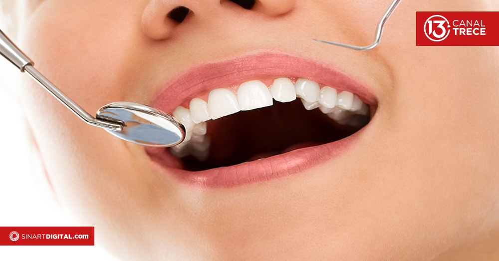 Fractura en dientes, ¡no todo está perdido!  