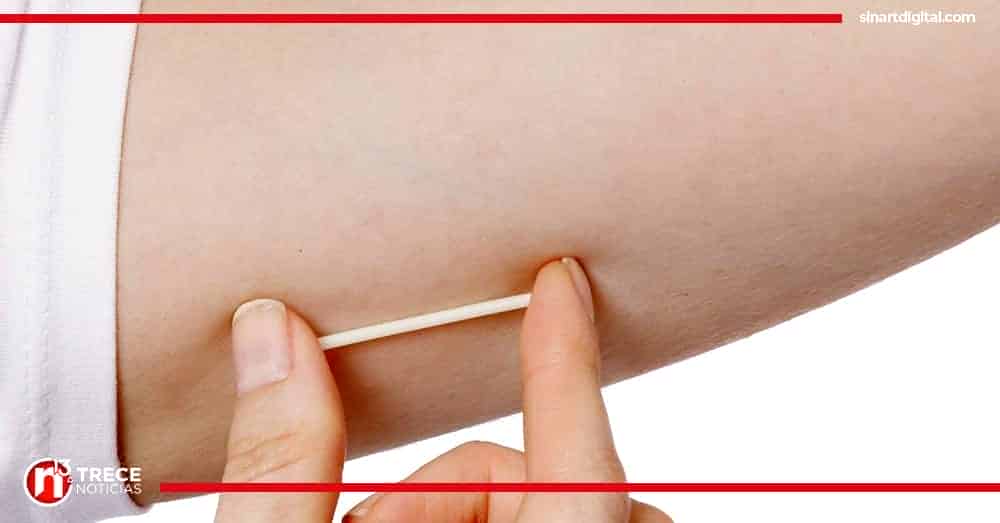 CCSS cambiará implantes anticonceptivos a muchachas este sábado