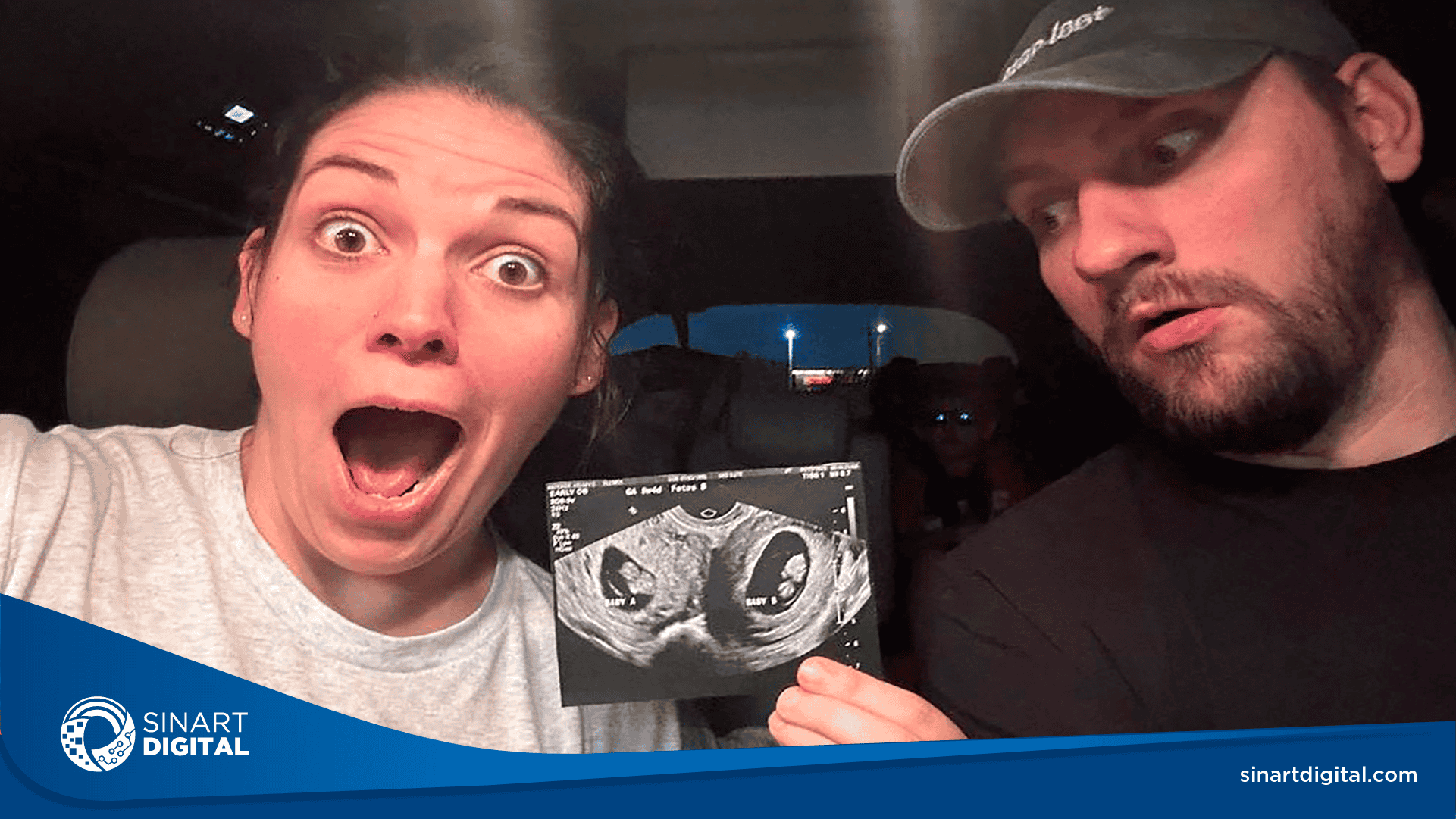 Mujer con inusual útero doble está embarazada en ambos