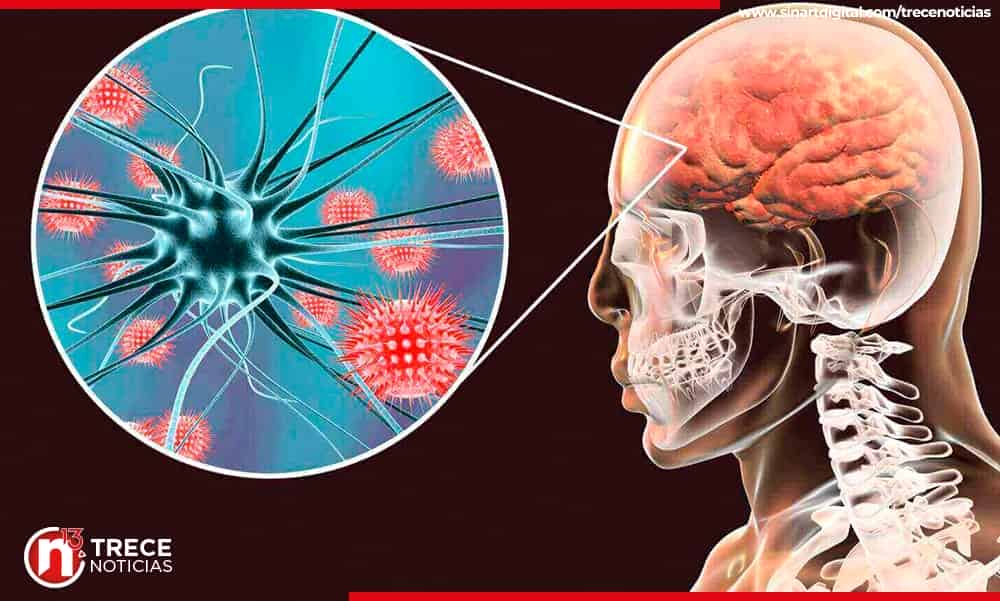 Buscan en México a 400 posibles contagiados de meningitis fúngica tras alerta de EEUU