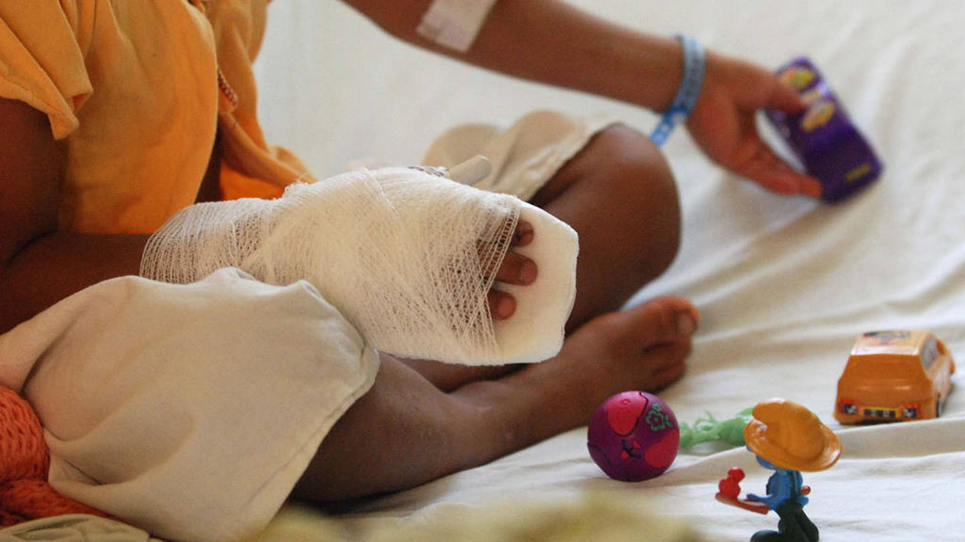 Dos niños se encuentran en la UCI del Hospital de Niños por quemaduras 