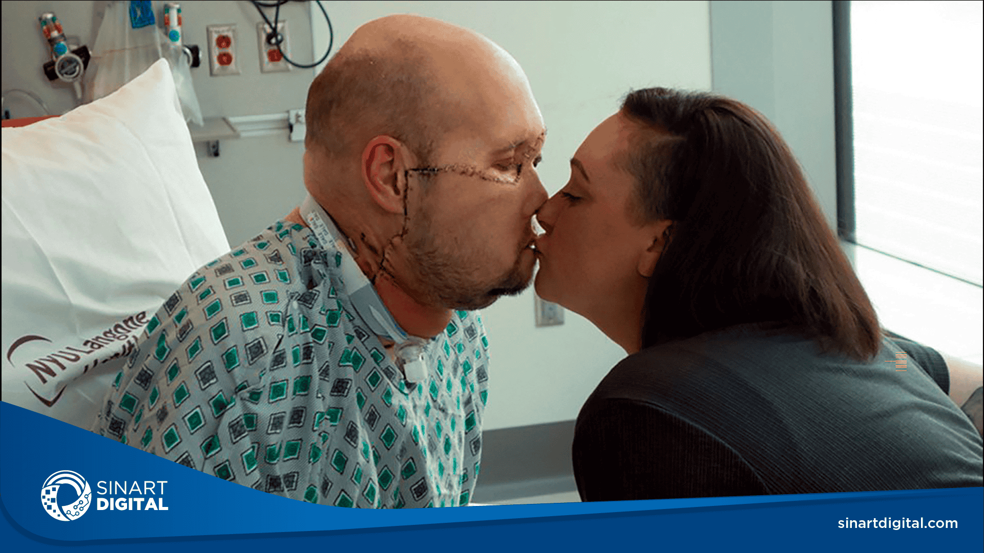 Cirujanos realizan el primer trasplante de ojo completo del mundo