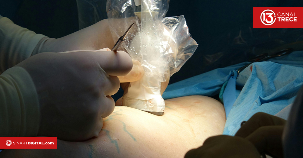 ¿Sufriendo por las varices? Todo lo que debe saber al respecto 