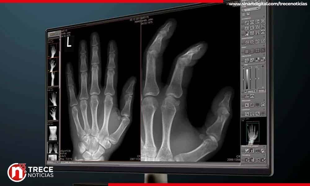 CCSS compra 33 nuevos equipos de rayos X digitales