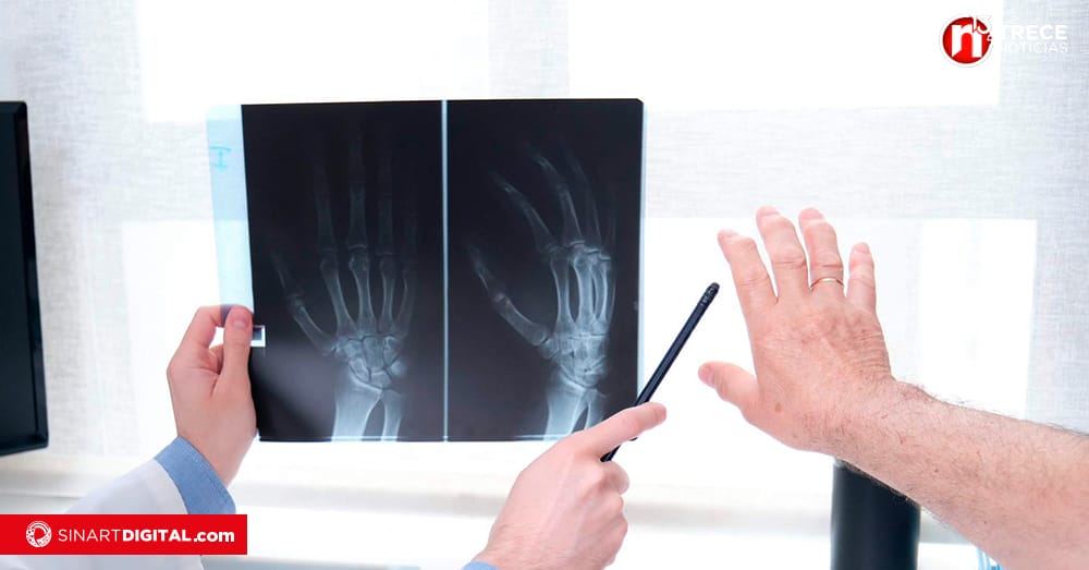 Reconozca los síntomas de las enfermedades reumatológicas 