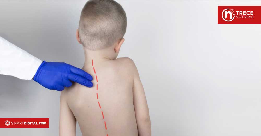 Escoliosis puede avanzar sin causar dolor, advierten especialistas