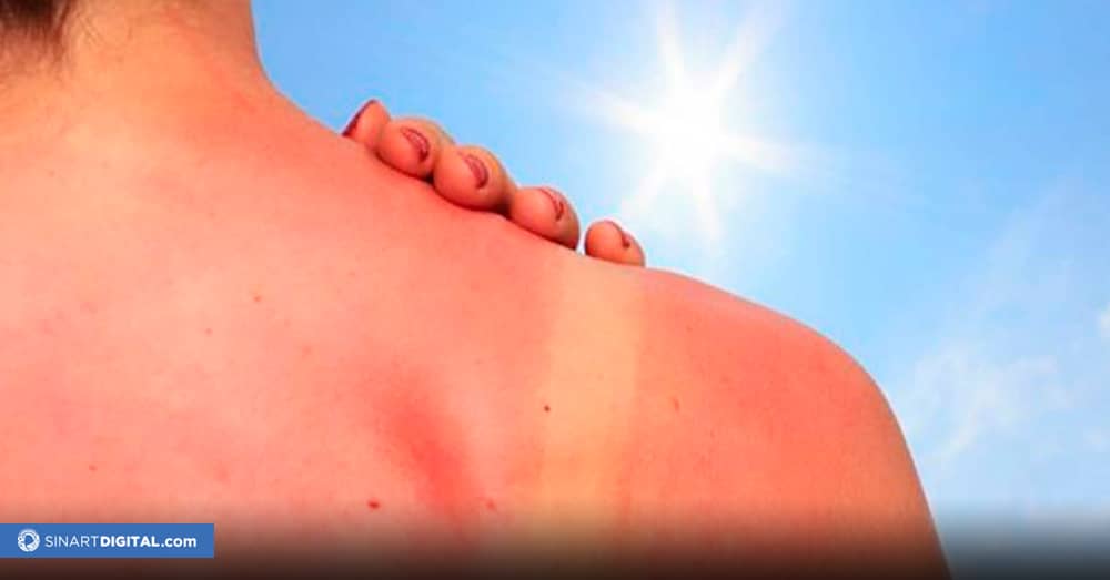 Cuidado con el cáncer de piel en este verano 