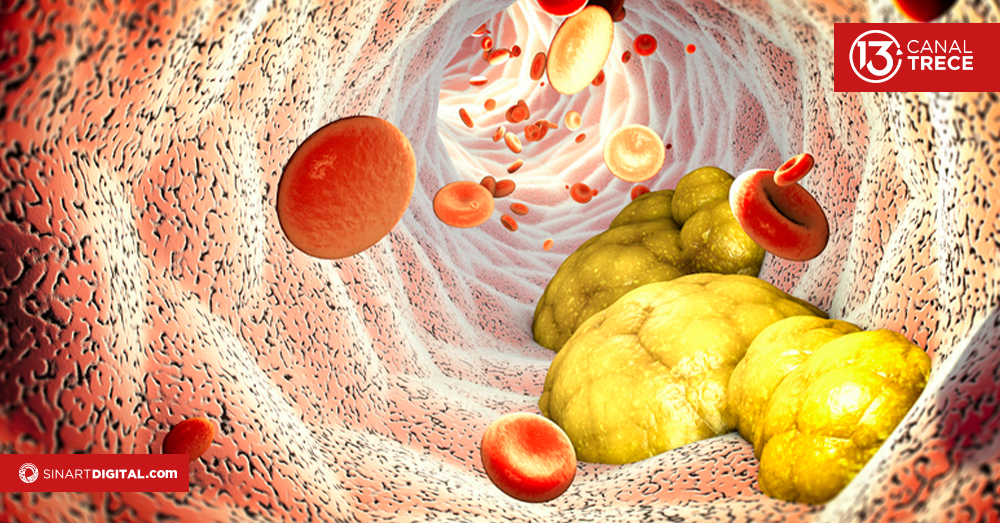 ¿Cómo bajar los triglicéridos de manera natural?